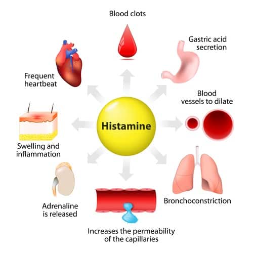 histamine reactions